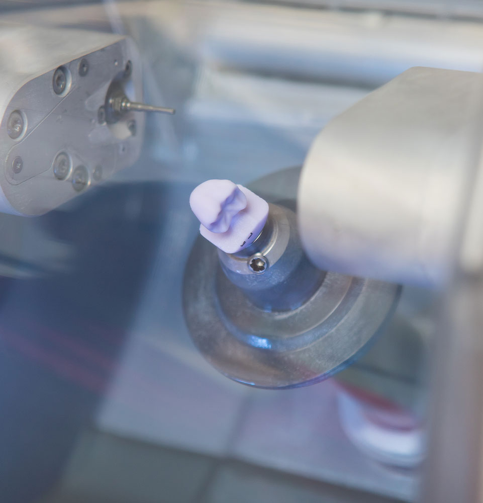 cerec machine